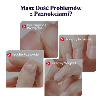 💜 3 az 1-ben körömápoló toll [Vegyél 1-et, és kapsz 2-t ingyen]💅