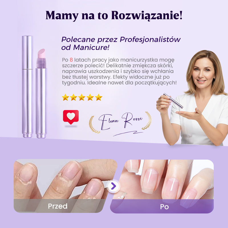 💜 3 az 1-ben körömápoló toll [Vegyél 1-et, és kapsz 2-t ingyen]💅