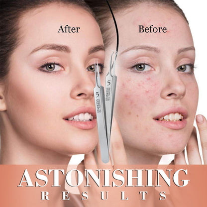 Speciális csipeszek szépségszalonok számára