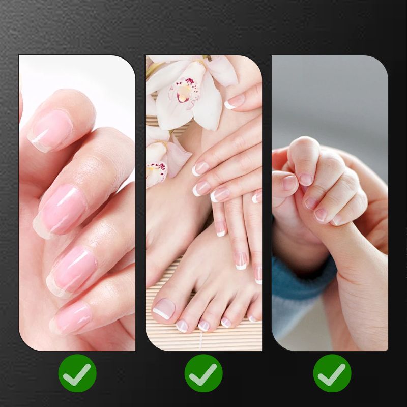 🔥 1+1 INGYEN 👴💖 Vízálló, Széles Állású Körömvágó ✂️💅