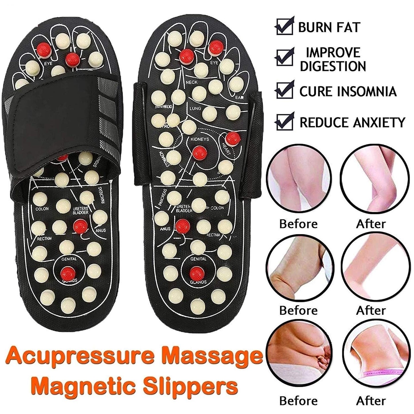 🔥Acupresszúra és mágneses terápiás papucsok
